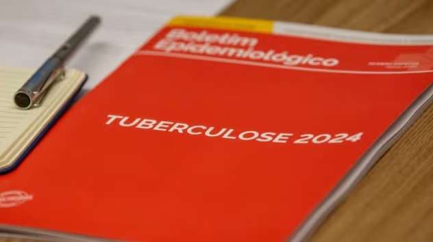 tubrculose