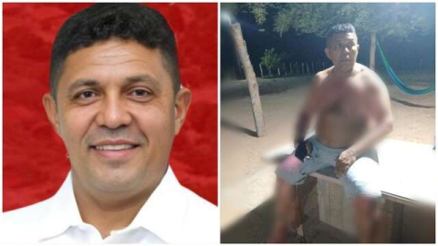 Tentativa de homicídio: Mulher ateia fogo em vereador por suposto flagrante com outra 