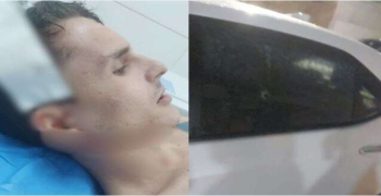 Filho de empresário é baleado na cabeça durante assalto ao chegar em casa