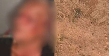 Idosa de 73 anos é amarrada e agredida por criminosos durante assalto e tem R$ 10 mil levados