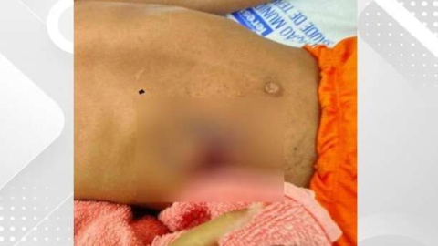 Criança de 4 anos é baleada acidentalmente por outra enquanto brincavam em casa