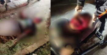Homem tem rosto desfigurado durante agressão
