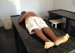 edilson