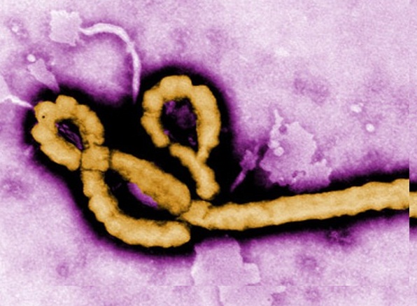 ebola