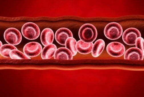 anemia