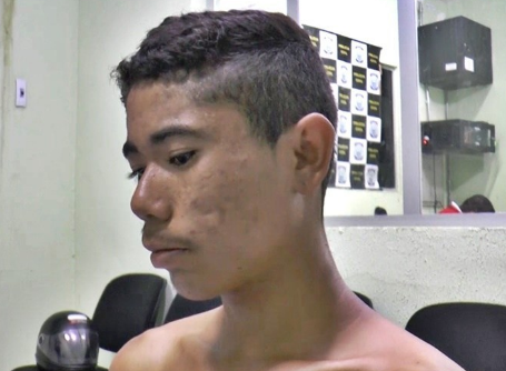 reverson