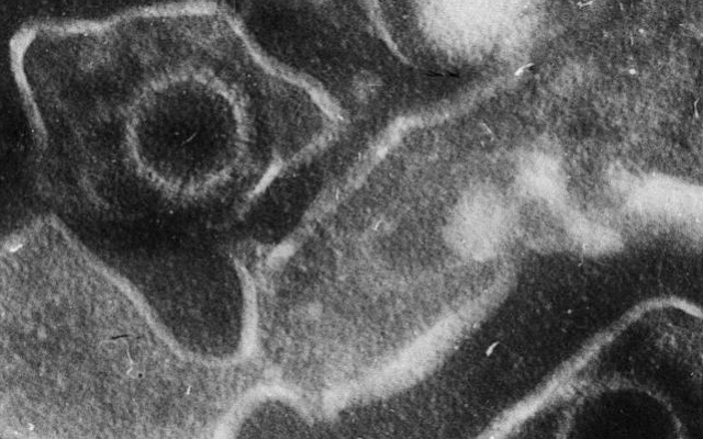 antivirais