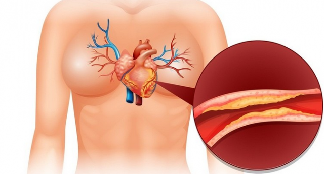 bacterisintestinais