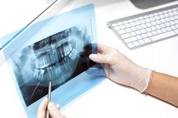cancerdente