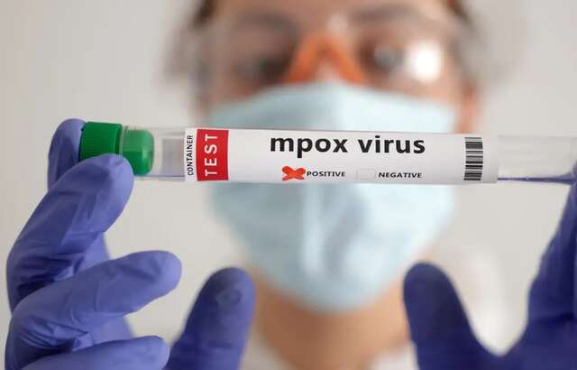 mpoxvirus