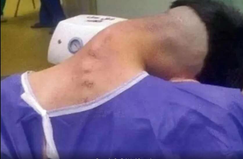 cabeça