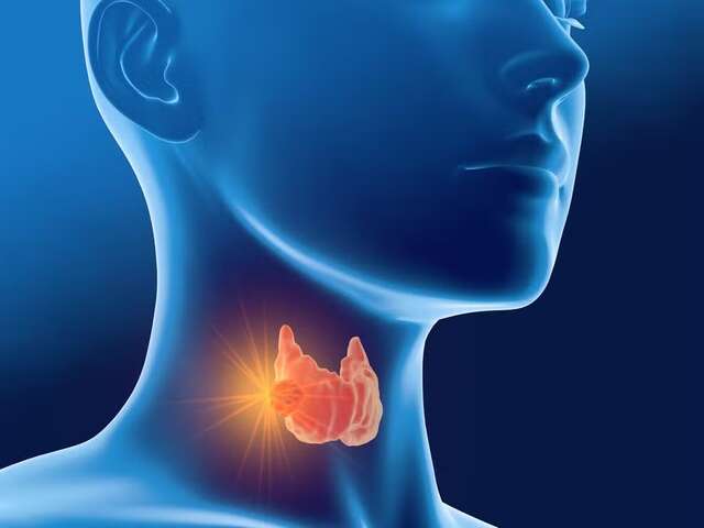 cancertireoide
