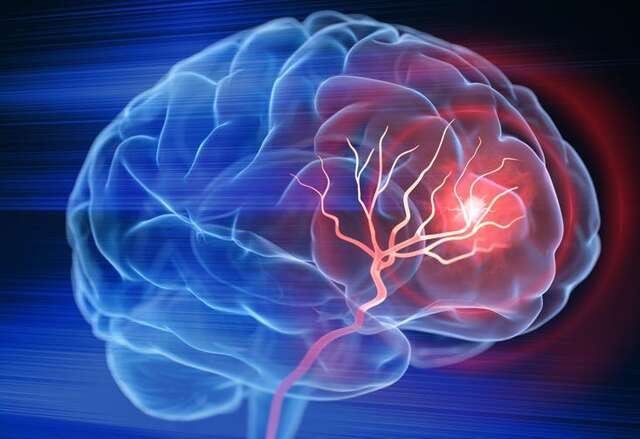 cerebro