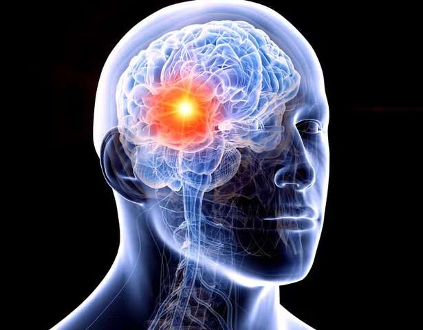 cerebrocancer
