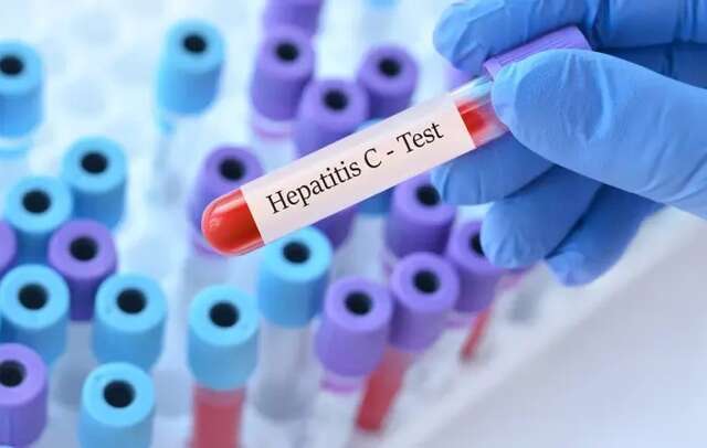 hepatite