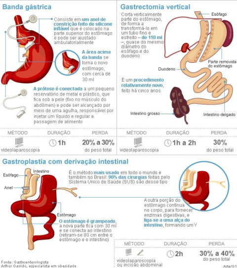 cirurgia11102012