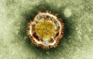 coronavirus1322013