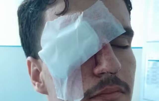 torcedorolho