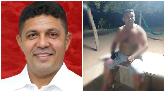 Tentativa de homicídio: Mulher ateia fogo em vereador por suposto flagrante com outra